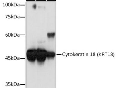 Cytokeratin 18 (KRT18) Rabbit mAb (A19778)
