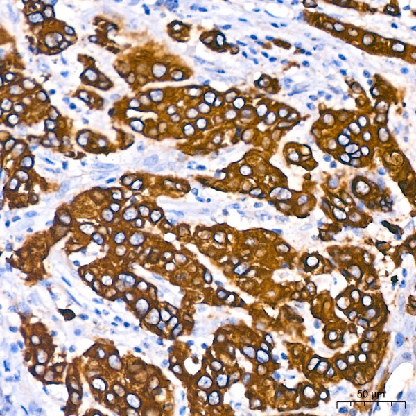 A19778: Cytokeratin 18 (KRT18) Rabbit mAb