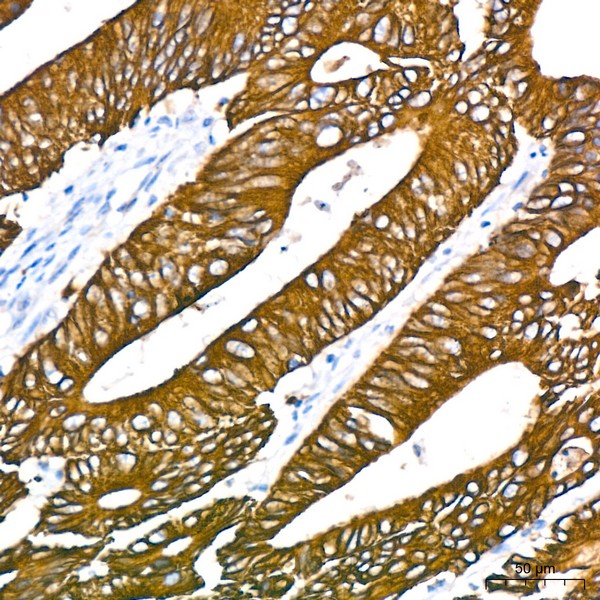 Cytokeratin 18 (KRT18) Rabbit mAb (Catalog Number: A19778) Abclonal