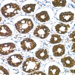 Abclonal Cytokeratin 18 (KRT18) Rabbit mAb (Catalog Number: A19778)