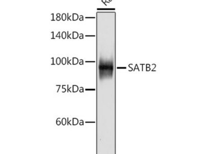 SATB2 Rabbit mAb (A19837)