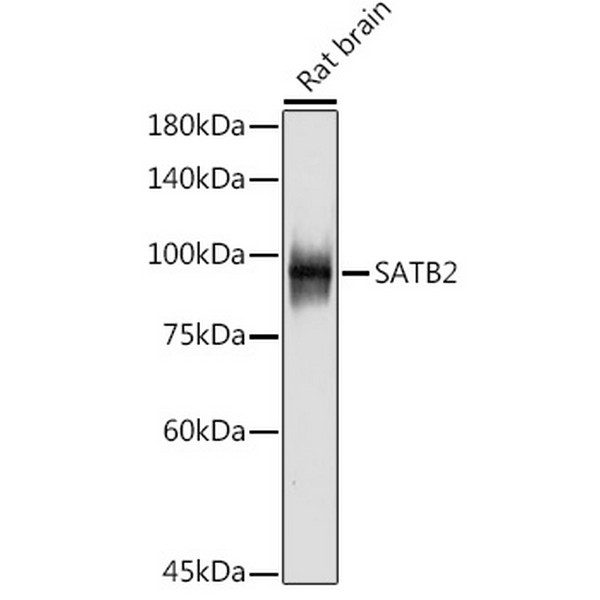 SATB2 Rabbit mAb (A19837) SATB2 Rabbit mAb (A19837)