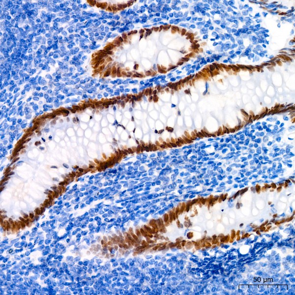 A19837: SATB2 Rabbit mAb