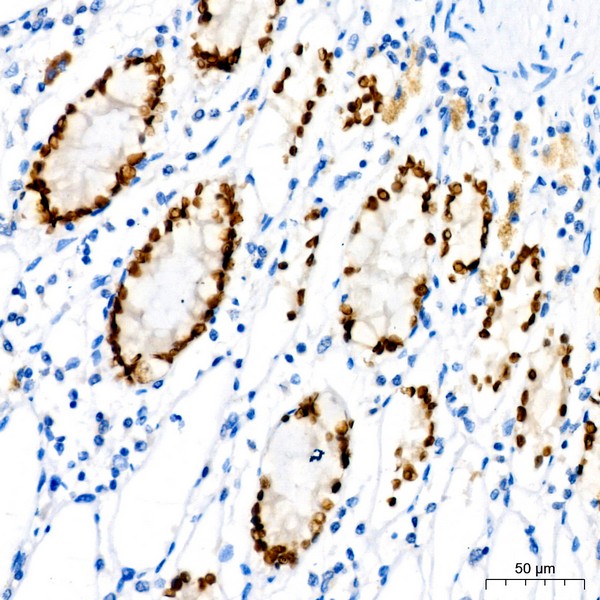 Abclonal SATB2 Rabbit mAb (Catalog Number: A19837)