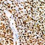 Ki67 Rabbit mAb (A20018)