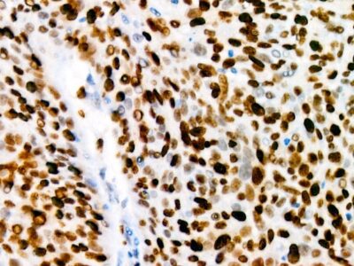 Ki67 Rabbit mAb (A20018)