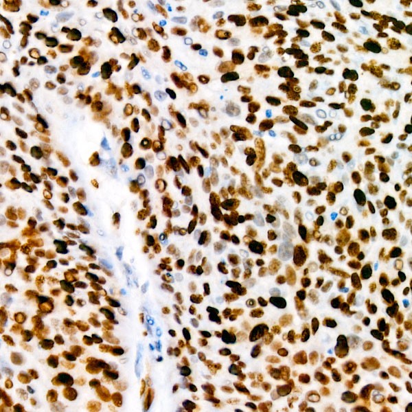 Ki67 Rabbit mAb (A20018) Ki67 Rabbit mAb (A20018)