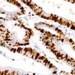 A20018: Ki67 Rabbit mAb