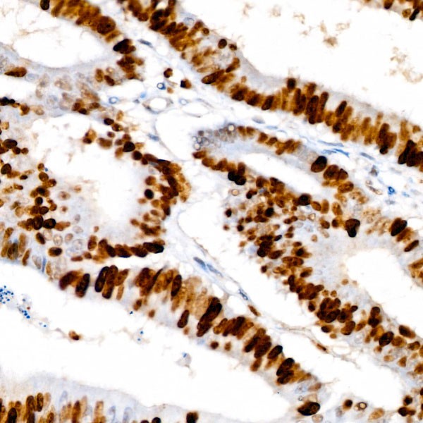 A20018: Ki67 Rabbit mAb