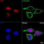 Ki67 Rabbit mAb (Catalog Number: A20018) Abclonal