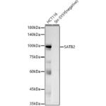 SATB2 Rabbit mAb (A20220)