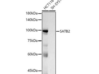 SATB2 Rabbit mAb (A20220)