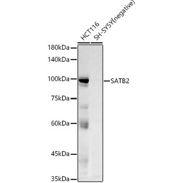 SATB2 Rabbit mAb (A20220) SATB2 Rabbit mAb (A20220)