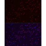SATB2 Rabbit mAb (Catalog Number: A20220) Abclonal