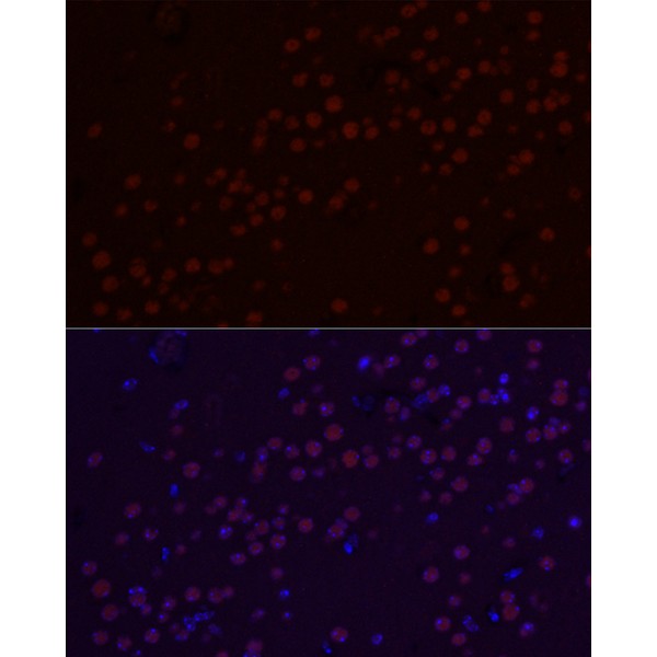 SATB2 Rabbit mAb (Catalog Number: A20220) Abclonal