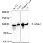 β-Catenin Mouse mAb (A20221)