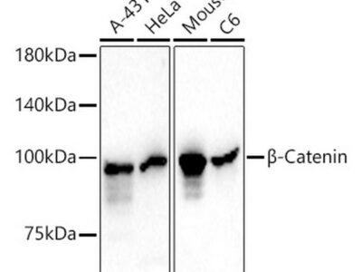 β-Catenin Mouse mAb (A20221)