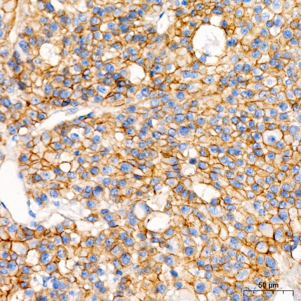 A20221: β-Catenin Mouse mAb