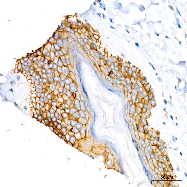 β-Catenin Mouse mAb (Catalog Number: A20221) Abclonal