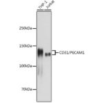 CD31/PECAM1 Rabbit mAb (A20228)