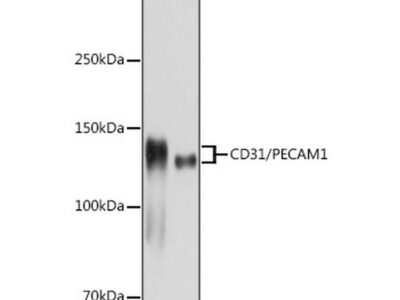 CD31/PECAM1 Rabbit mAb (A20228)