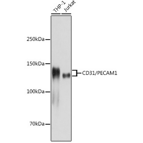 CD31/PECAM1 Rabbit mAb (A20228) CD31/PECAM1 Rabbit mAb (A20228)