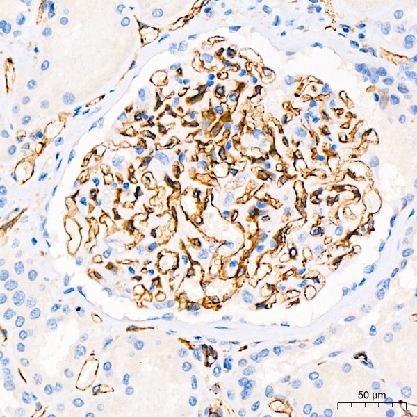 A20228: CD31/PECAM1 Rabbit mAb