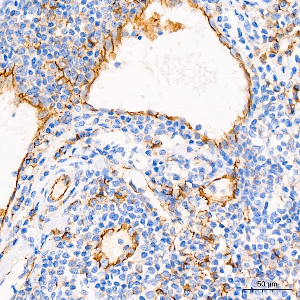 CD31/PECAM1 Rabbit mAb (Catalog Number: A20228) Abclonal