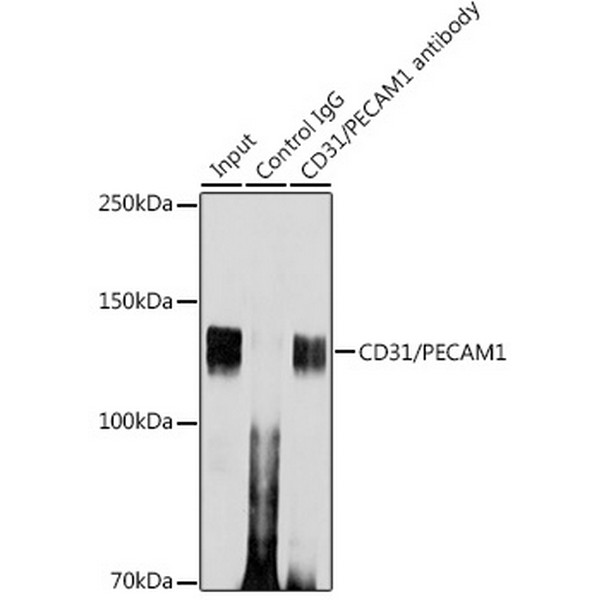Abclonal CD31/PECAM1 Rabbit mAb (Catalog Number: A20228)