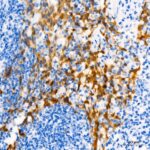 CDKN2A/p16INK4a Mouse mAb (A20371)