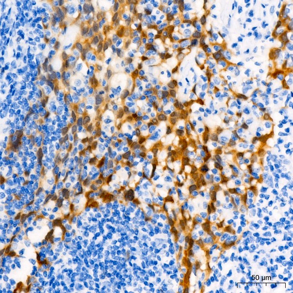 CDKN2A/p16INK4a Mouse mAb (A20371) CDKN2A/p16INK4a Mouse mAb (A20371)