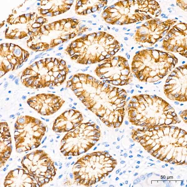 Claudin18.2 Rabbit mAb (A20420) Claudin18.2 Rabbit mAb (A20420)