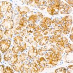 A20420: Claudin18.2 Rabbit mAb