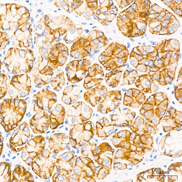 A20420: Claudin18.2 Rabbit mAb