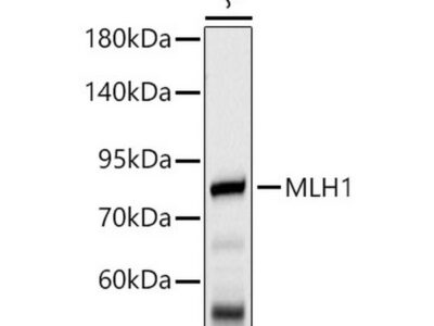 MLH1 Mouse mAb (A20544)