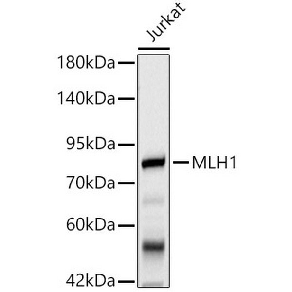 MLH1 Mouse mAb (A20544) MLH1 Mouse mAb (A20544)