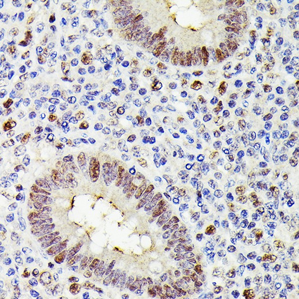 MLH1 Mouse mAb (Catalog Number: A20544) Abclonal