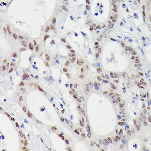 Abclonal MLH1 Mouse mAb (Catalog Number: A20544)