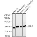 Villin1 Mouse mAb (A20545)