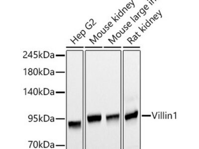 Villin1 Mouse mAb (A20545)