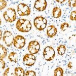 Abclonal Villin1 Mouse mAb (Catalog Number: A20545)