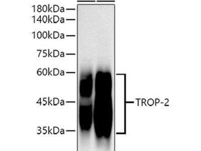 TROP-2 Rabbit mAb (A20824)