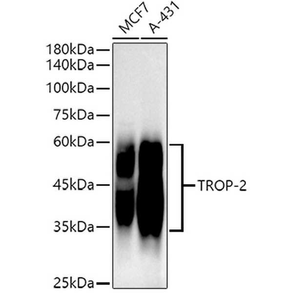 TROP-2 Rabbit mAb (A20824)