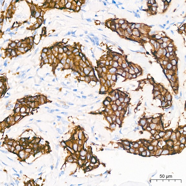 TROP-2 Rabbit mAb (Catalog Number: A20824) Abclonal