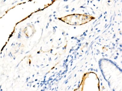 von Willebrand factor (VWF) Rabbit mAb (A21054)