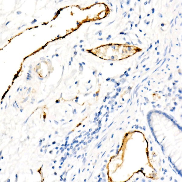 von Willebrand factor (VWF) Rabbit mAb (A21054) von Willebrand factor (VWF) Rabbit mAb (A21054)