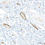 Abclonal von Willebrand factor (VWF) Rabbit mAb (Catalog Number: A21054)