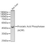 Prostatic Acid Phosphatase (PSAP) Rabbit mAb (A21195)