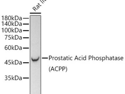 Prostatic Acid Phosphatase (PSAP) Rabbit mAb (A21195)