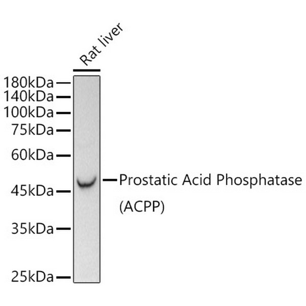 Prostatic Acid Phosphatase (PSAP) Rabbit mAb (A21195) Prostatic Acid Phosphatase (PSAP) Rabbit mAb (A21195)